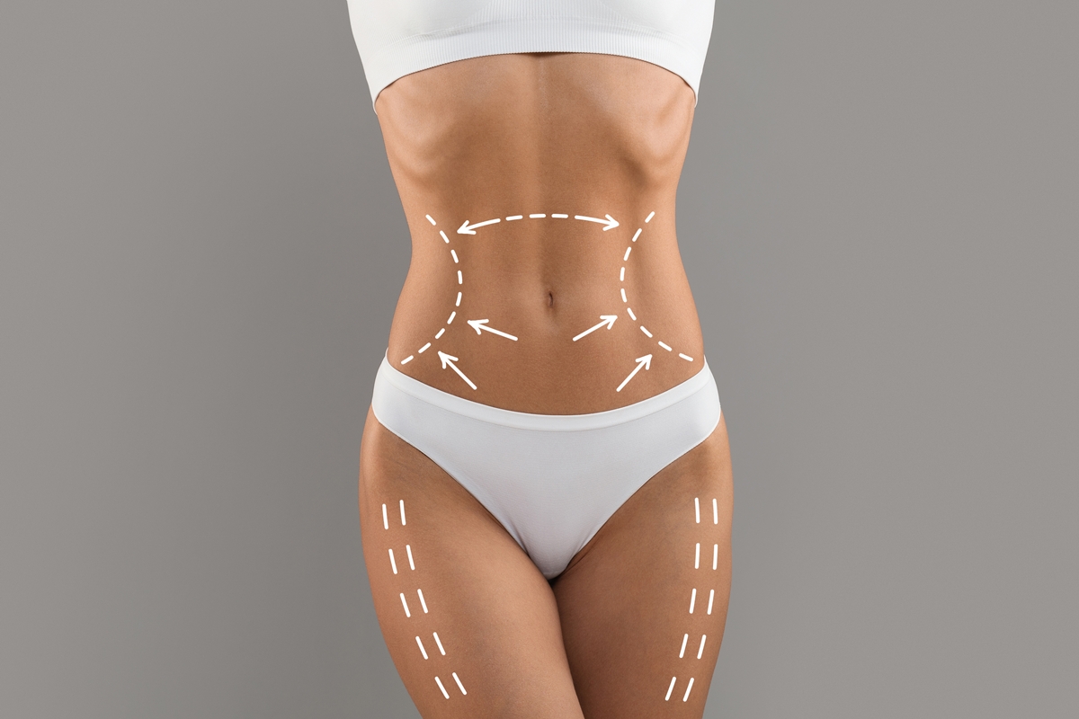 Non-Surgical Body Contouring with Lipomax Sculpt