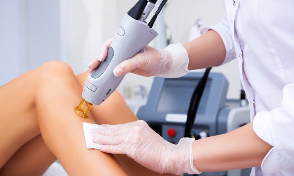 What are the Benefits of Laser Hair Removal Treatment